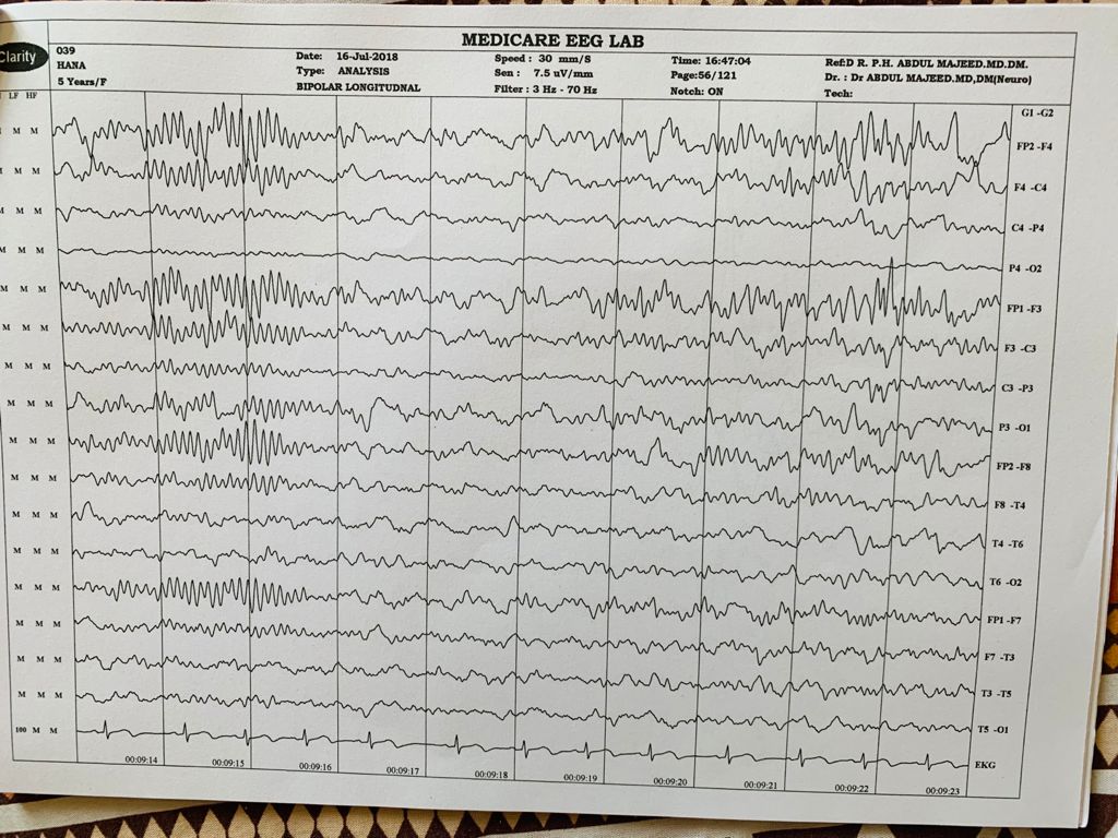 Patient Story